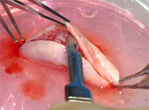 Preparing ovarian tissue for freezing