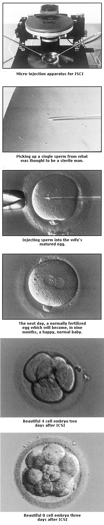 ICSI-IVF