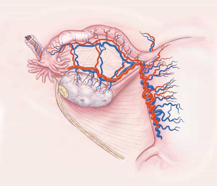 NEJM_OvaryTransplantDiagramA