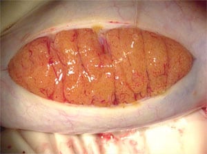 Normal testis anatomy. Stay on periphery, but expose every anatomic lobule.