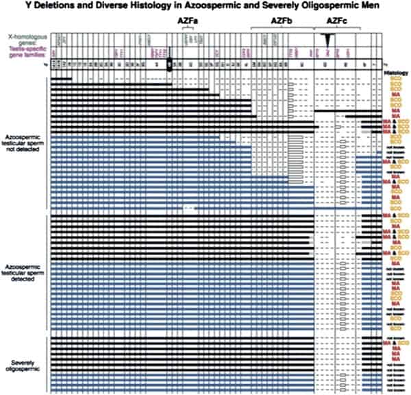 Figure 10: Early map of major Y chromosome deletions in azoospermic men and the diversity of pathologic defects [118].