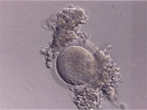 Figure 7: Partial cumulus denudation prior to vitrification of GV oocytes.