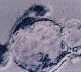 A well-developed 5-day blastocyst.