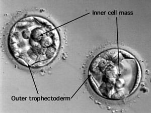 Embryos (blastocysts) cultured in vitro before transferring back to patient.