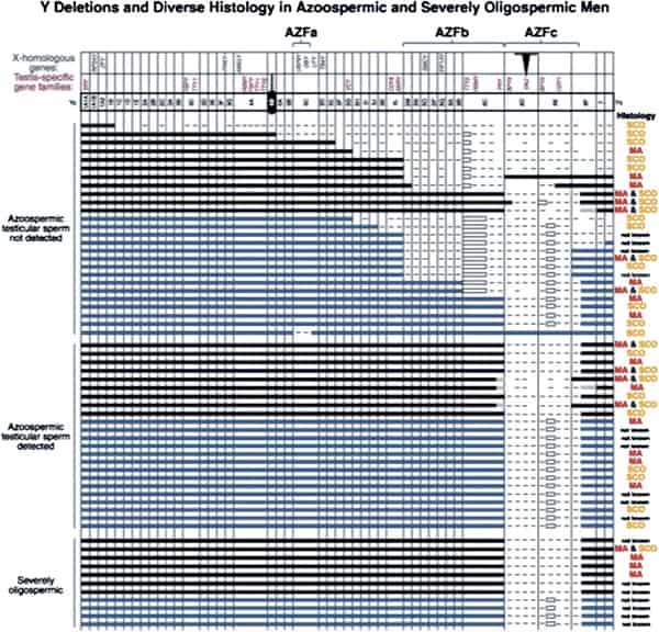 Figure 1. Early map of major Y chromosome deletions in azoospermic men and the diversity of pathologic defects (3).