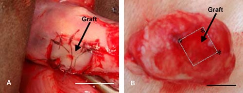 Figure 4: (A) Gross morphology of bovine ovary with vitrified ovarian tissue immediately after autotransplantation. Ovarian cortical piece measuring 1 × 10 × 10 mm in size was grafted onto the ovary after the cortex of this ovarian tissue had been removed and vitrified. Cortical piece was sutured and marked using the nylon strings. (B) Gross morphology of bovine ovary with vitrified ovarian tissue 44 days after autotransplantation. Marking by the nylon strings of the graft is clearly visible (asterisk). Scale bars represents 10 mm.