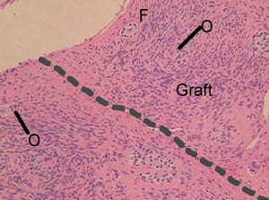 Figure 5. Histological section of vitrified bovine ovarian tissue 44 days after autotransplantation. The graft is above the dotted line and the original cortex is under the dotted line. Interstitial tissue of the graft was as good as in the original bovine ovary. The blood vessels (V), oocytes (O) and follicles (F) of the graft were also morphologically normal with no sign of diminution in numbers. Haematoxylin–eosin staining. Scale bar represents 50 μm.