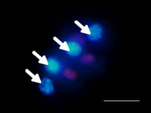 Figure 7. Surviving oocytes (arrows) of pre-antral follicles of vitrified–thawed ovarian tissue in human (Hoechst/propidium iodide stain). Nuclei of living oocytes were blue. Scale bar represents 50 μm.