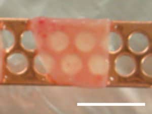 Figure 8. Gross morphology of vitrified human ovarian tissue using the Cryotissue method. Vitrified human ovarian tissue was translucent in liquid nitrogen (–196°C). Scale bar represents 10 mm.