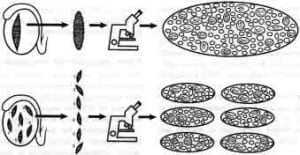 Figure 1. Diagram of testicular mapping methodology, Sertoli cell-only. Microsurgical and histological observations of a large contiguous slice of testicular tissue is shown in the upper panel. A similar study of multiple discontinous biopsies is illustrated in the lower panel. In Sertoli cell-only, the larger tubules contain spermatozoa, and the tubules devoid of spermatozoa are much thinner in diameter.