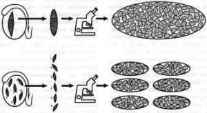 Figure 2. Diagram of a testicular mapping methodology showing maturation arrest (see Figure 1 for explanation). In this case, tubules with spermatozoa are similar in size (no bigger) than tubules without spermatozoa.