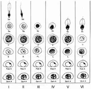 Figure 3 The six stages (I-VI) of spermatogenesis in the human. In any one focus, i.e., in any one small area of the seminiferous tubule, there is an orderly progression from less mature to more mature cells: Type A spermatogonia. Type B spermatogonia. L, leptotene spermatocytes; Z, zygotene spermatocytes; P, pachytene spermatocytes; Sa and Sb, early spermatids; Sc and Sd, late spermatids. There is, however, a chaotic placement of these various stages of spermatogenesis in a random mix in humans rather than in an orderly wave as in other animals along the seminiferous tubule. The meiotic phase of spermatogenesis occurs when the pachytene (P) spermatocyte divides into two early spermatids.