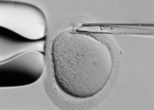 Removing a polar body from the egg for genetic testing.