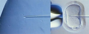 Left: During the ICSI procedure, the sperm is captured and immobilized. Right: Injection of the sperm into the egg.