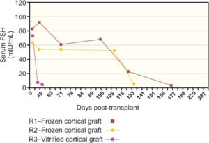 Figure 42.4B: After a frozen cortical re-transplant, serum FSH declined again to normal levels, similar to those of fresh transplants