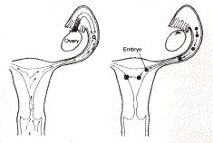 left caption: Normal fertilization in fallopian tube Right Caption: Implantation in uterus 