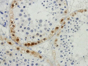 Normal spermatogenesis: Mage Stain.