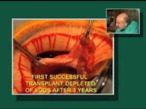 Dr. Sherman Silber Discusses Ovarian Transplantation