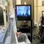 Dr. Silber Details Sperm Retrieval With Local Anesthesia