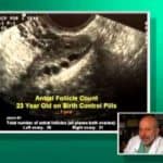 Egg and Ovary Banking to Preserve Fertility Chapter 2