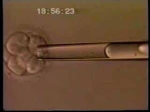 Embryo Biopsy