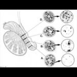 Dr Sherman Silber Azoospermia