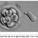 figure 13-3